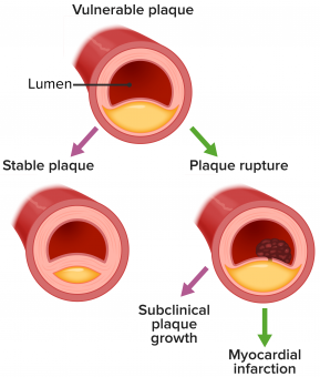 PLAC®- ja oksidoitunut LDL -testi – (näytteenottopakkaus)